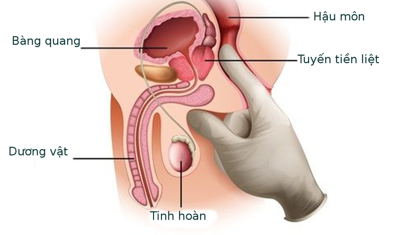 Những bệnh dễ mắc sau tuổi 40 